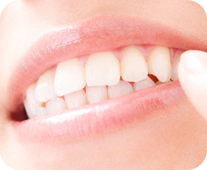 ホワイトニング